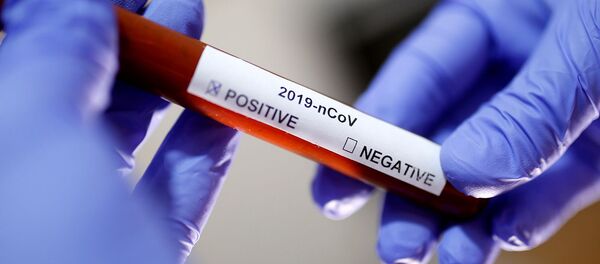 Инсценировка пробирки с положительным результатом теста на короновирус - Sputnik Армения