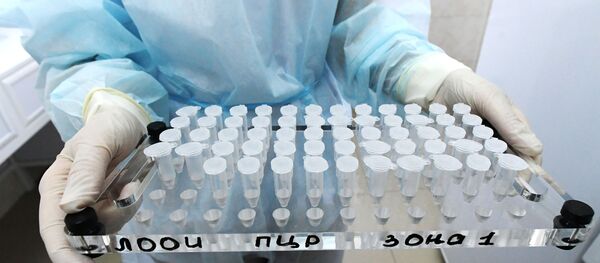 Тест-системы для диагностики нового коронавируса  - Sputnik Արմենիա