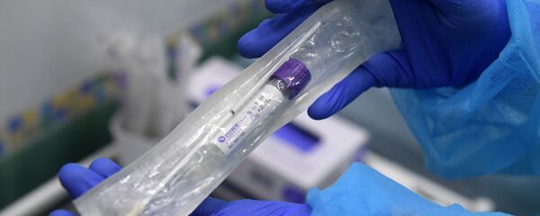 Пробирка с тестом на коронавирус в руках у сотрудницы в медицинской лаборатории в Москве Пробирка с тестом на коронавирус в руках у сотрудницы в медицинской лаборатории в Москве - Sputnik Արմենիա