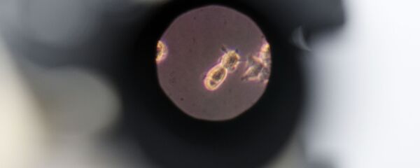 Образец биоматерилала под микроскопом  - Sputnik Արմենիա