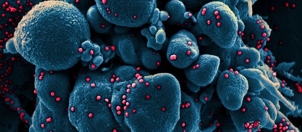 Вид на зараженную коронавирусом клетку под микроскопом - Sputnik Армения