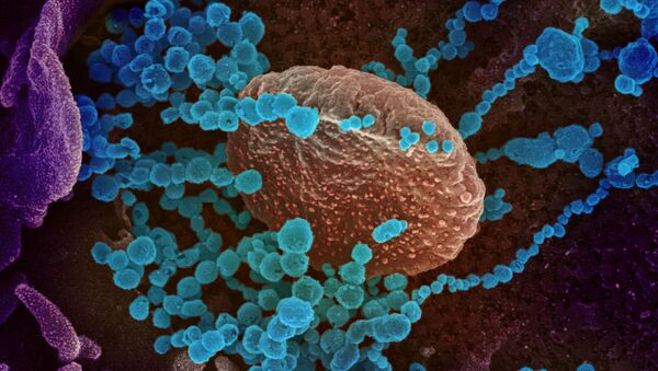 Вид на зараженную коронавирусом  клетку под микроскопом  - Sputnik Армения