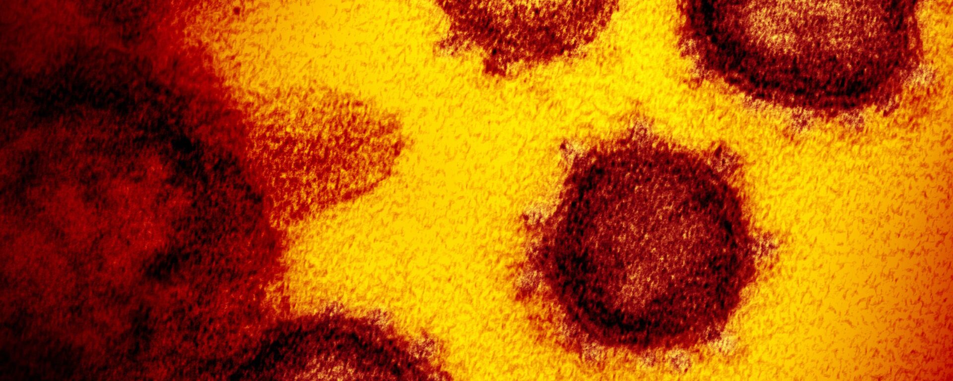 На снимке с помощью электронного микроскопа виден новый коронавирус SARS-CoV-2, появляющийся на поверхности клеток. Он вызывает COVID-19 - Sputnik Армения, 1920, 16.02.2021