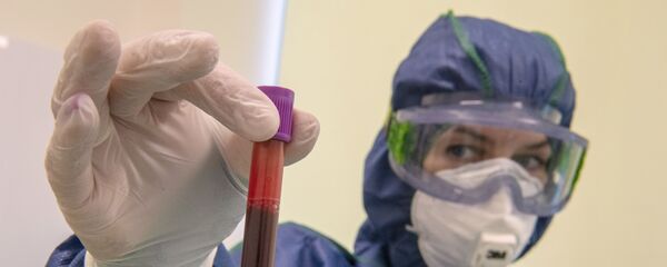Экспресс-диагностика на антитела к коронавирусу в клинике Hadassah Medical Moscow в Сколково - Sputnik Արմենիա