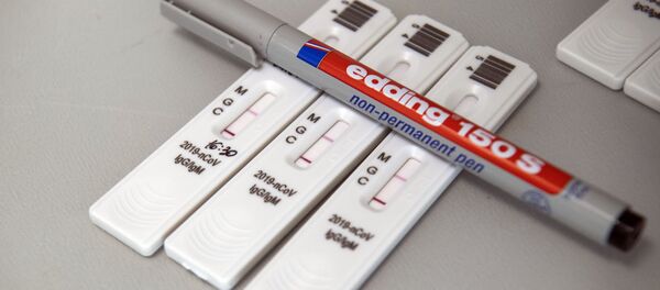 Экспресс-тесты на коронавирус в лаборатории - Sputnik Армения