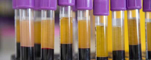 Экспресс-диагностика на антитела к коронавирусу  - Sputnik Արմենիա