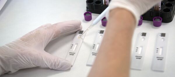 Экспресс-диагностика на антитела к коронавирусу. Архивное фото Экспресс-диагностика на антитела к коронавирусу. Архивное фото - Sputnik Армения