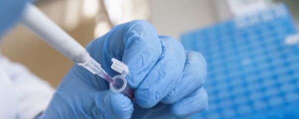 Емкость с антигеном с меткой в лаборатории  - Sputnik Армения