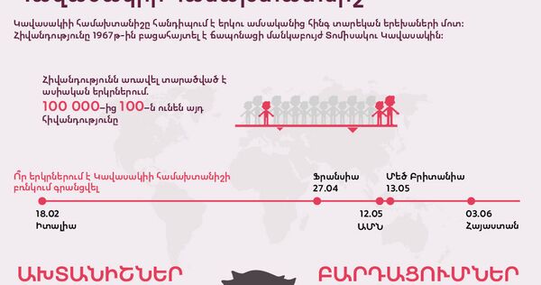 Կավասակիի համախտատնիշ - Sputnik Արմենիա