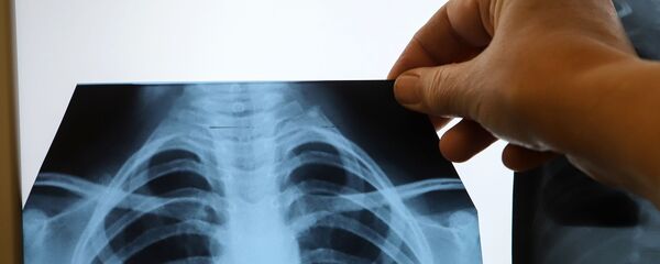 Врач с рентгеном легких в инфекционном корпусе, где лечат пациентов с COVID-19 Врач с рентгеном легких в инфекционном корпусе, где лечат пациентов с COVID-19 - Sputnik Արմենիա