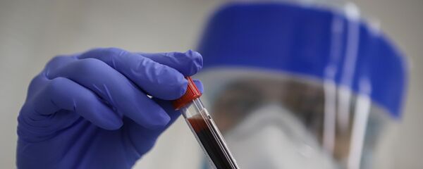 Тестирование на антитела к коронавирусу - Sputnik Արմենիա