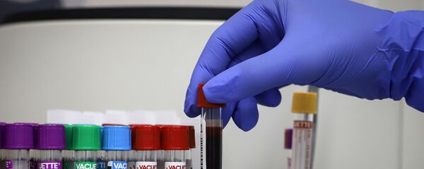 Тестирование на антитела к коронавирусу - Sputnik Արմենիա