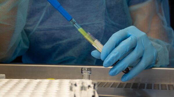 Лаборатория для проведения тестов на антитела к коронавирусу в Республиканском центре профилактики СПИДа - Sputnik Արմենիա