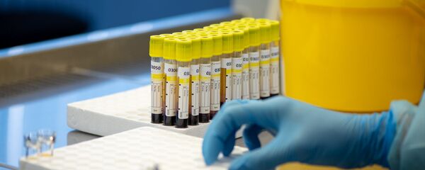 Лаборатория для проведения тестов на антитела к коронавирусу в Республиканском центре профилактики СПИДа - Sputnik Армения