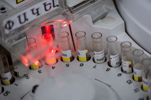 Նոր հետազոտություն Հայաստանում. Covid 19–ը կբացահայտվի ևս մեկ թեստով Նոր հետազոտություն Հայաստանում. Covid 19–ը կբացահայտվի ևս մեկ թեստով - Sputnik Արմենիա