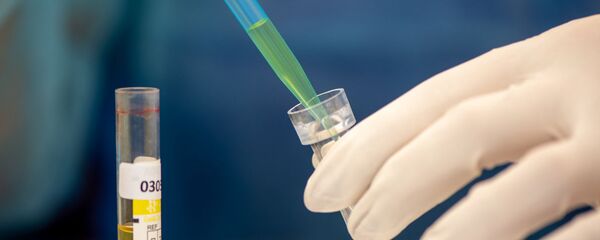 Лаборатория для проведения тестов на антитела к коронавирусу в Республиканском центре профилактики СПИДа - Sputnik Армения
