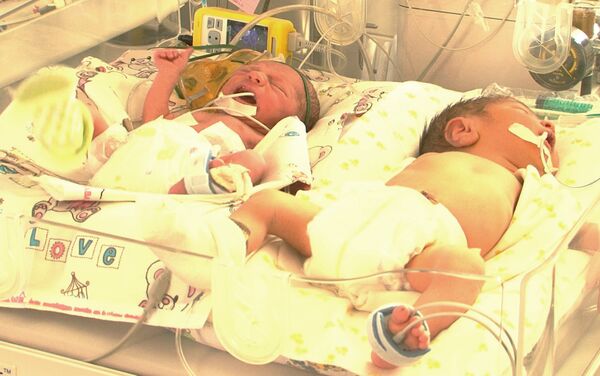 ԱՆ Պերինատոլոգիայի, մանկաբարձության և գինեկոլոգիայի հանրապետական կենտրոնում թերի քաշով ծնված երեխաներին հատուկ ապարատներով են խնամում - Sputnik Արմենիա