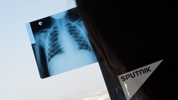 Рентген - Sputnik Армения