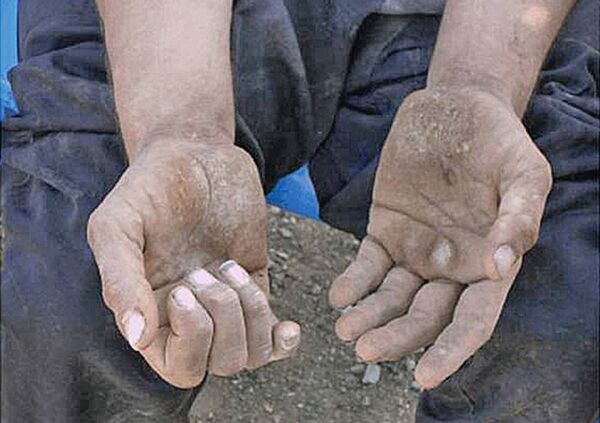 Люди, которые перемещаются на четвереньках Люди, которые перемещаются на четвереньках - Sputnik Արմենիա