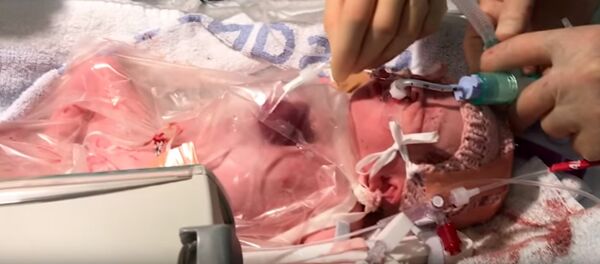 Девочка с сердцем наружу - Sputnik Армения